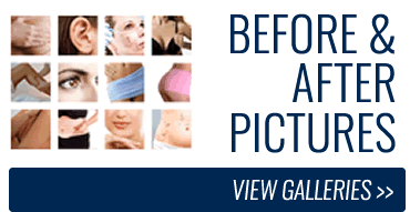 Before After Gallery